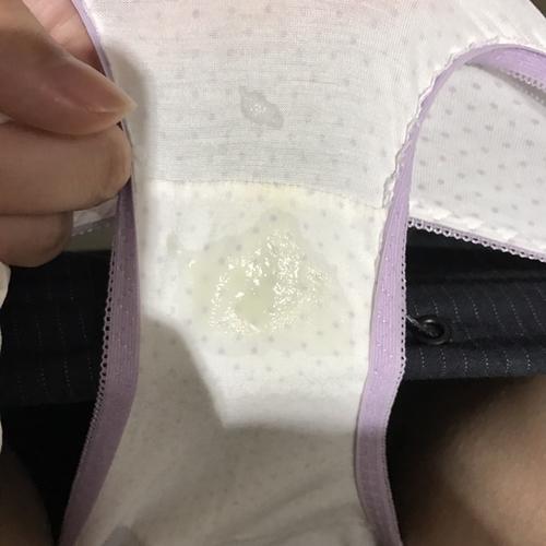 孕初期 每天都有这样的白带 无异味 正常吗