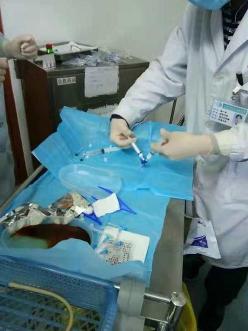 一例下肢静脉曲张 肝血管瘤患者经介入治疗解决问题