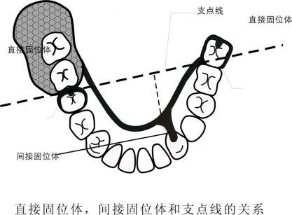 设计间接固位体,固位体到支点线的垂直距离最好等于或大于从鞍基