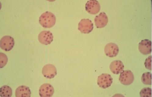 猫巴尔通体(hemobartonella)