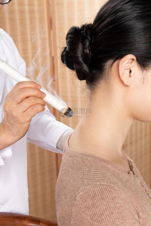 艾灸高清图片下载-正版图片501206138-摄图网