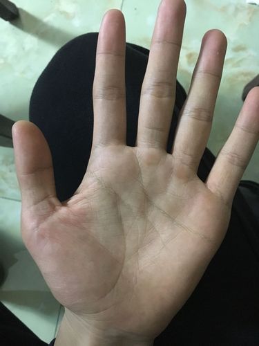 智慧线从中间断开了,不知道代表什么,大神帮忙分析一下啊!