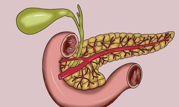 胰腺癌来的前期,身上往往会出现征兆,只是太多人当成是胃病