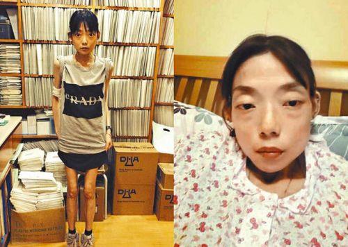 郭永淳前妻骨瘦如柴