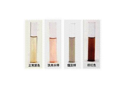 常接触化学品要小心膀胱癌?