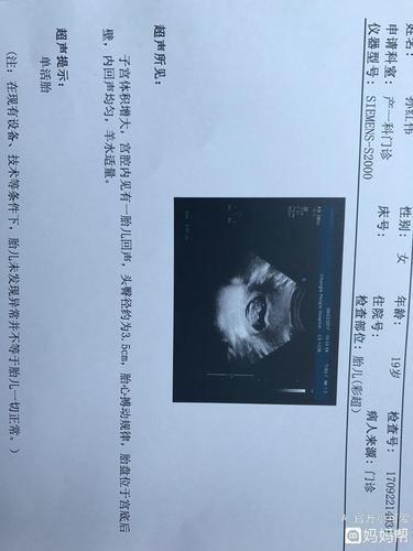 宝宝两个月半就已经成型了 是不是基本确定是男孩了