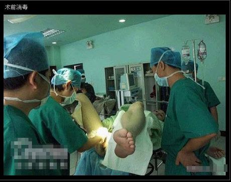 实拍:混血儿变性手术全过程