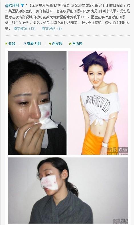 李依馨被某明星藏獒咬伤? 横店:怀疑不高明的个人炒作