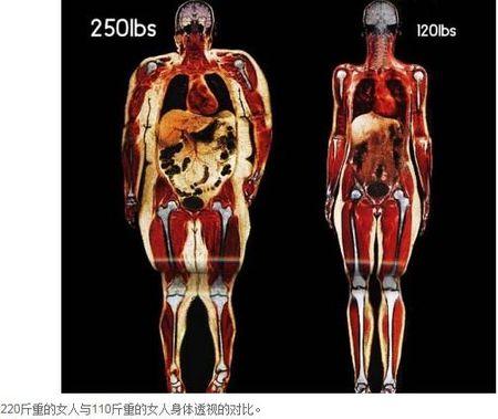 脂肪 是什么样子的,有没有图片?