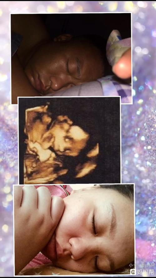 孕25周四维照片孩子哪里像我哪里像