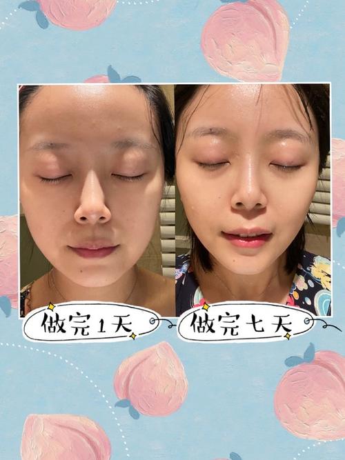 【热拉提plus】恢复七天情况!#对比图