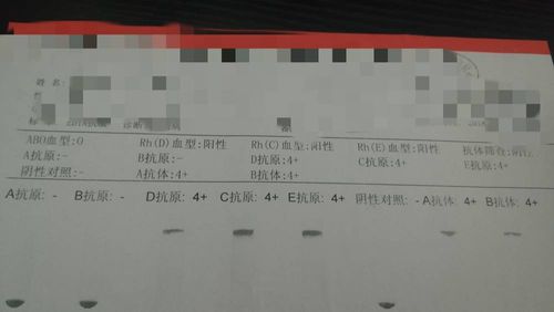 这血型鉴定表怎么看?