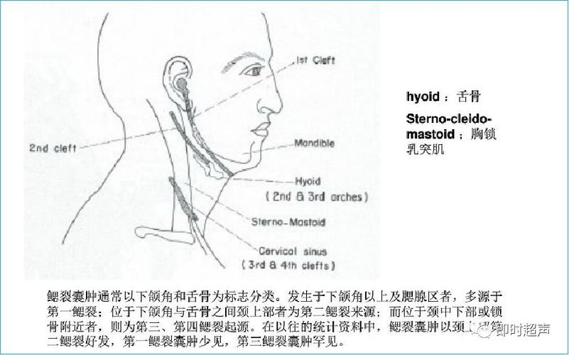 鳃裂囊肿部位示图