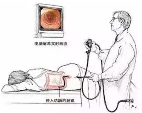 如果说"灌肠"是一门艺术,有些男人已经玩到无法自拔