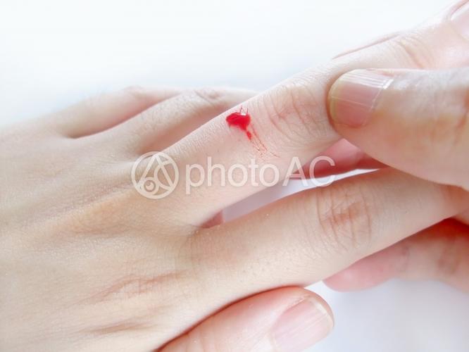 照片素材(图片): 手指受伤