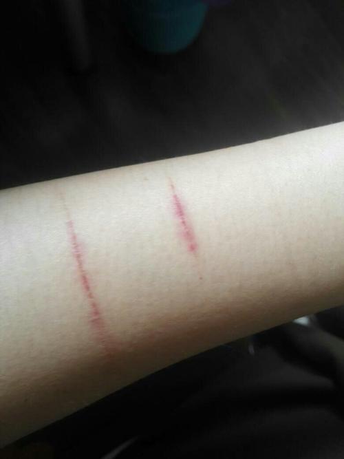 胳膊上有两天前不小心刮的皮肉伤 好像已经结咖了