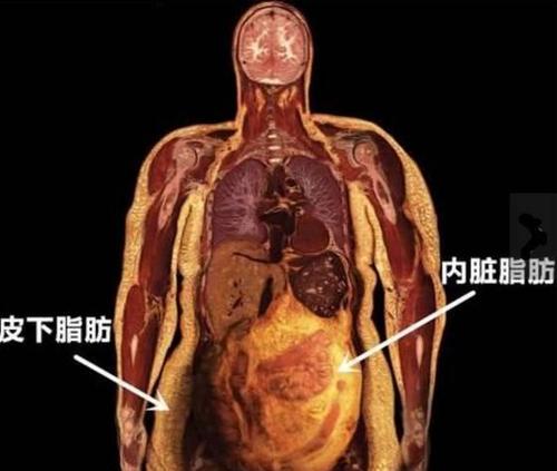 小测试你的内脏脂肪多吗教你三招轻松减脂肪