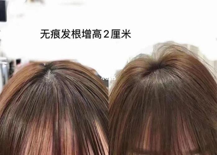 头发太贴头皮了怎么办_贴头皮_发根烫摩根烫头顶蓬松