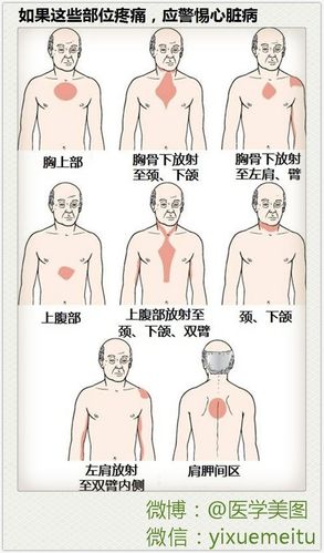 健康科普 l 如果这些部位疼痛,应警惕心脏病