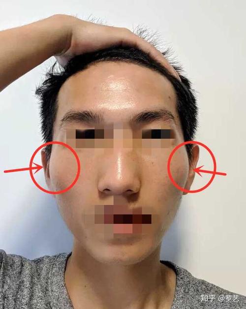 男生颧骨高有什么合适的短发发型推荐?