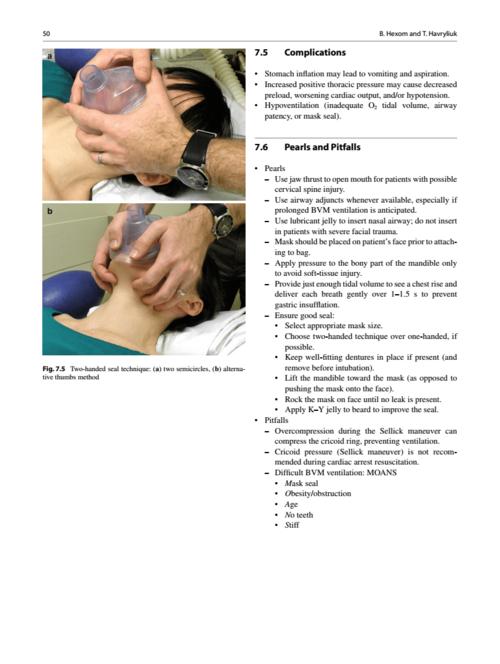 球囊面罩通气.pdf 5页