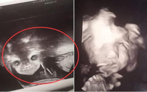 孕24周b超检查,当看到宝宝的样子后,孕妈有些吓到了