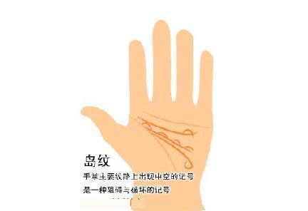 手相图解:手掌岛纹是什么样的,有什么影响?