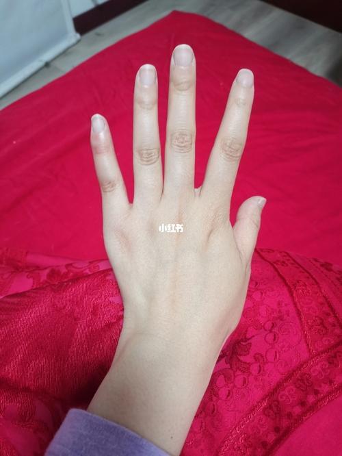 第一眼看我的手,它好像没有毛病. 嗯……怎么大拇指的的指甲这么宽?
