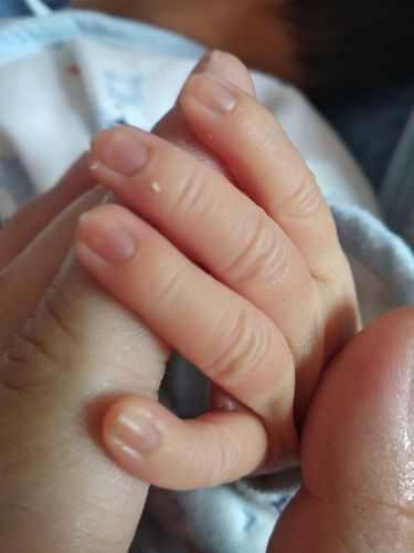 新生儿指甲颜色正常吗