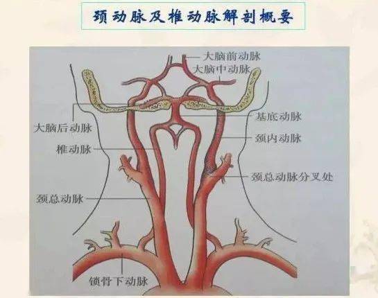 除了颈椎病,也要当心椎动脉狭窄!
