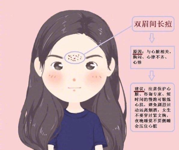 双眉间长痘
