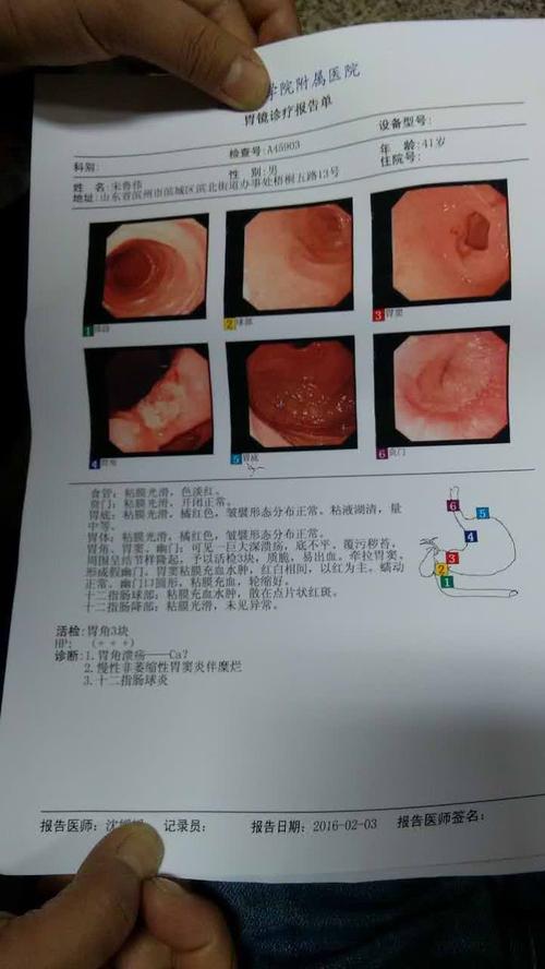 真是有什么别有病,当医生看到胃镜照片的时候非常震惊,严重的胃溃疡