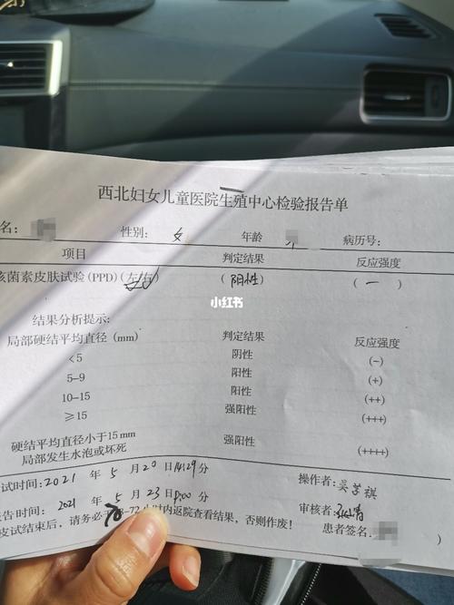 ppd皮试_护士_医疗健康_医疗健康其他