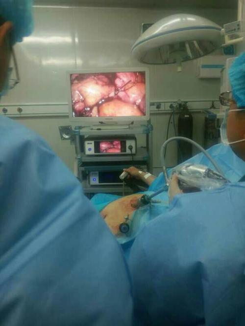 腹腔镜子宫全切除术