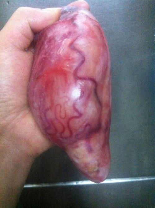 女性们,你们同意变性人(男变女)手术后进女厕所小便吗