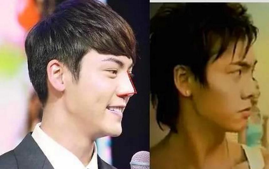 陈伟霆才是整容最成功的男星!昔日蒜头鼻太普通,身边杨颖太吸睛