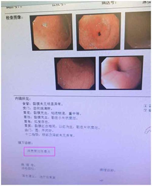 当时就去了家附近的医院,医生开了胃镜,检查是"慢性浅表性胃炎"