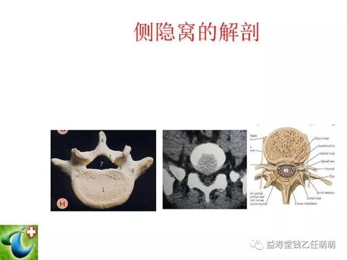 侧隐窝,椎间孔注射等临床实用技术