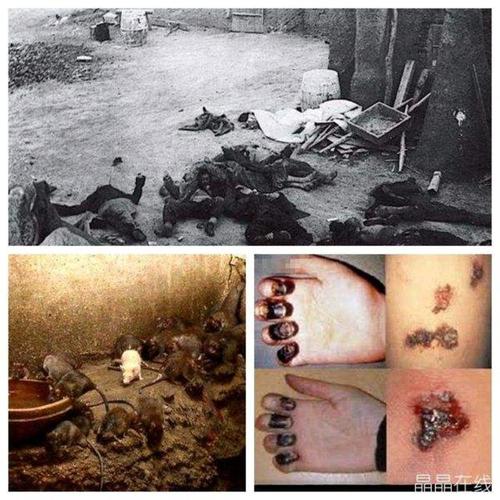 黑死病(鼠疫)图片