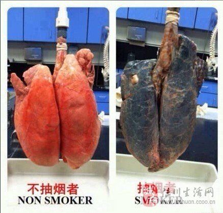 吸烟人的肺经典图片