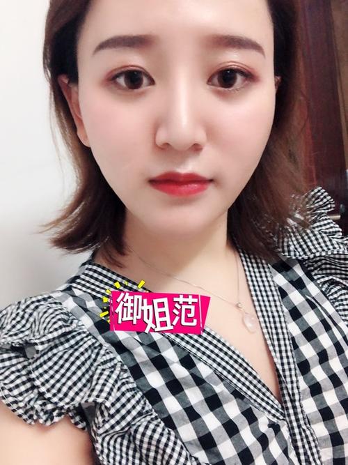 微整形是不是不会留疤