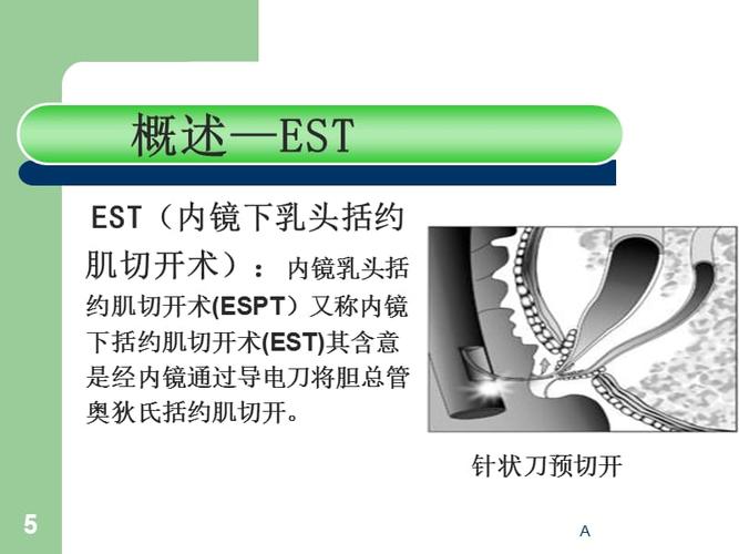 ercp及术前术后护理.ppt
