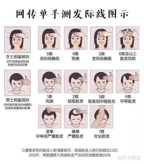 请问我的发际线是高是低?