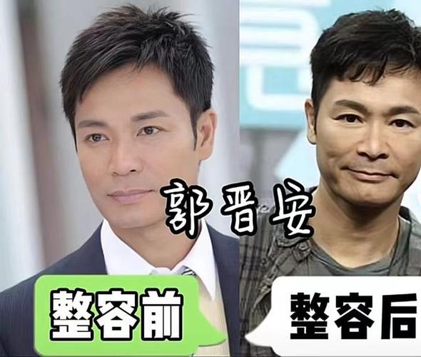 盘点那些整容失败的五位男明星最后一位丑到爹妈都不认识