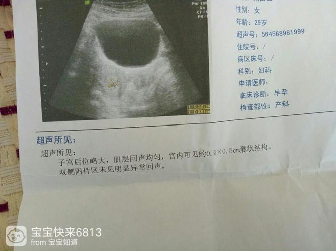 37天的孕囊正常吗