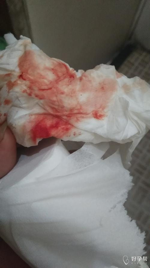 月经不干净,一直鲜红鲜红的,怎么办急急急-经期延长-月经量多-备孕