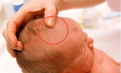 出现这5种情况时,家属要趁早带宝宝