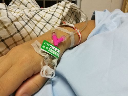 手术室里输液时的滞留针.