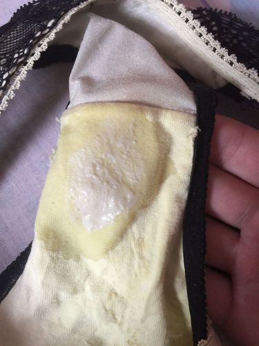 请帮我看一下,这样的白带是怎么回事,正常么?