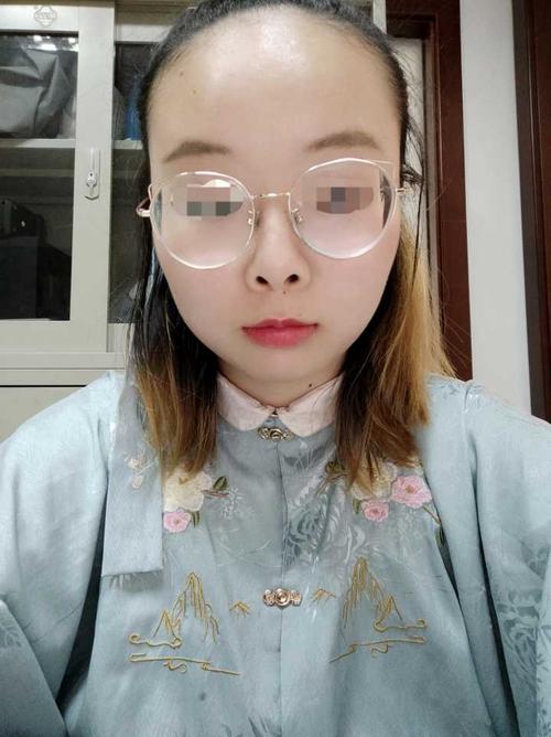 没有刘海,看看这大脸大脑门和发际线